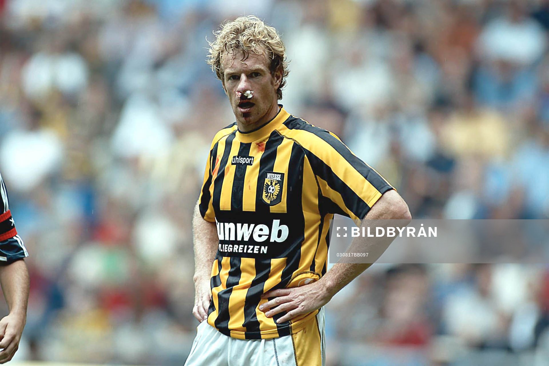 Bert Konterman, Vitesse, näsblod, skada