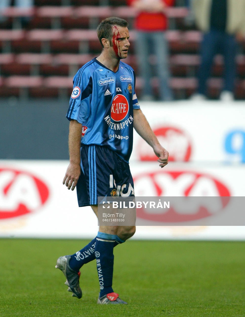 Markus Karlsson, Djurgården. Skada, blod