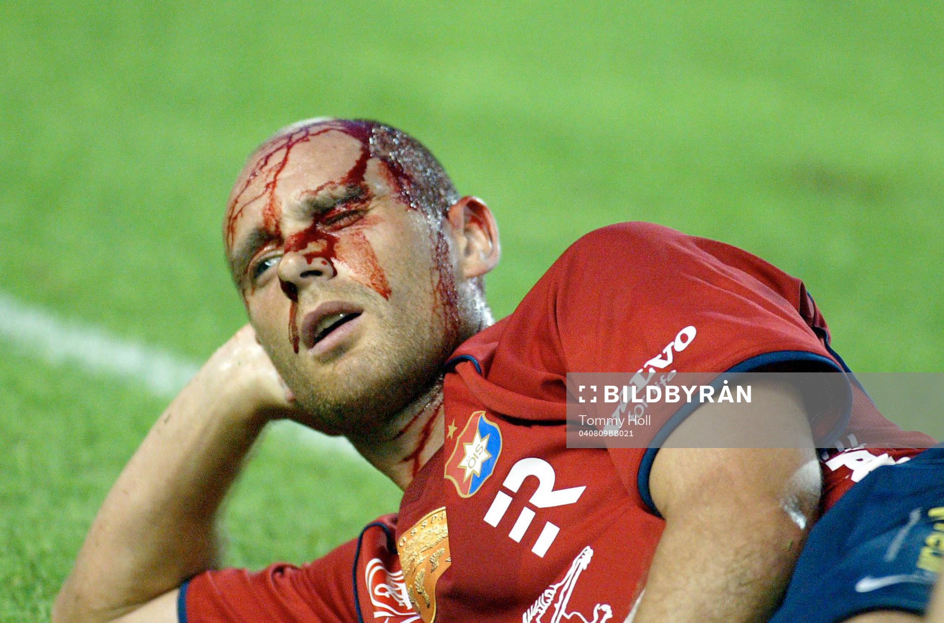 Tryggvi Gudmundsson, Örgryte skadad