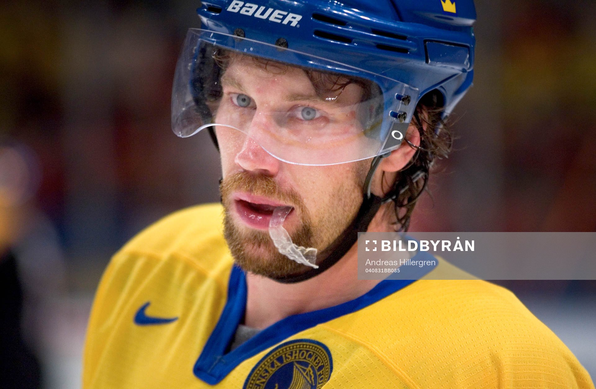 Peter Forsberg, Sverige (Tandskydd)