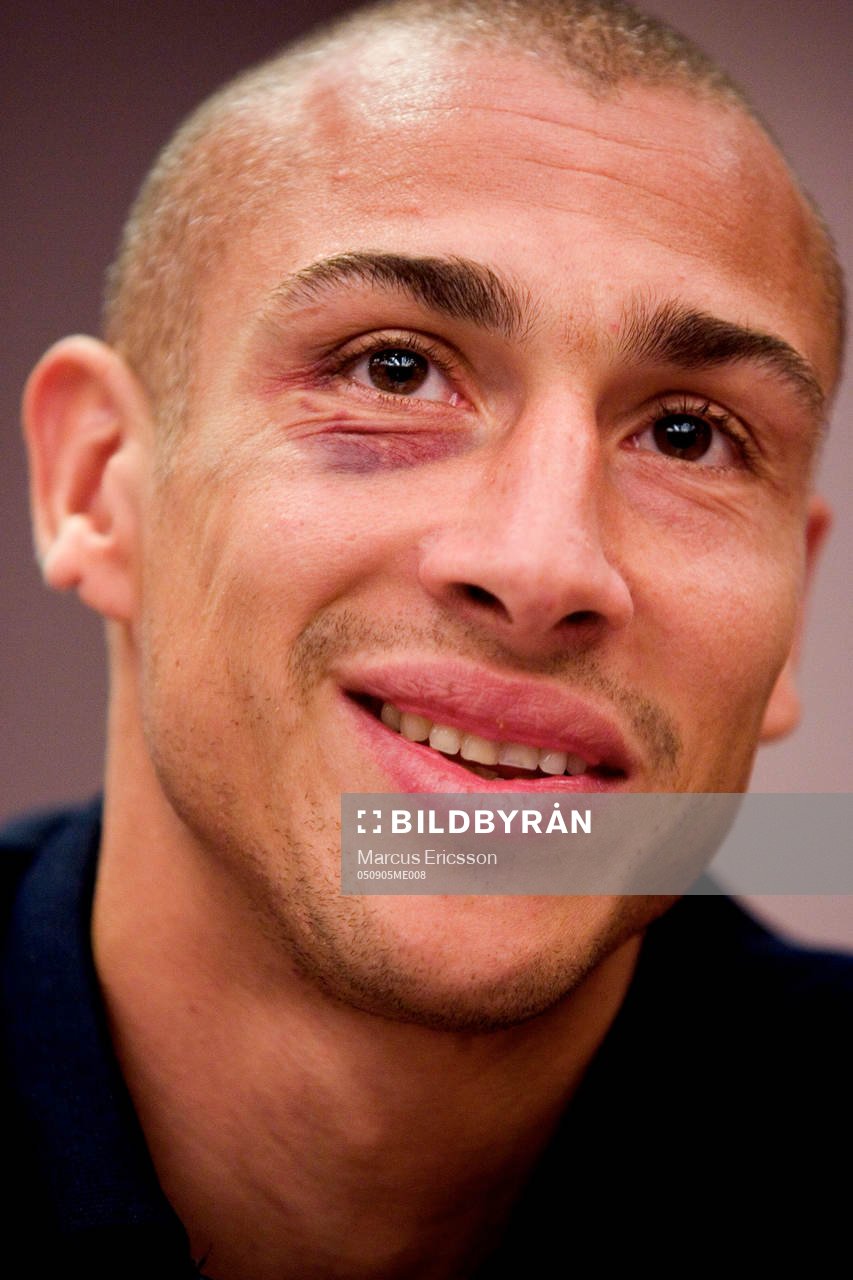 Henrik Larsson med blåöga