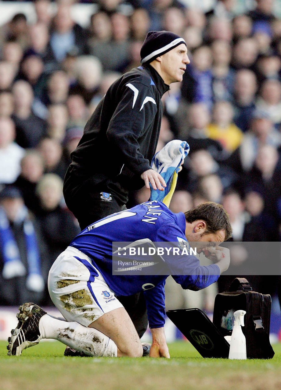 James McFadden, Everton, skadad