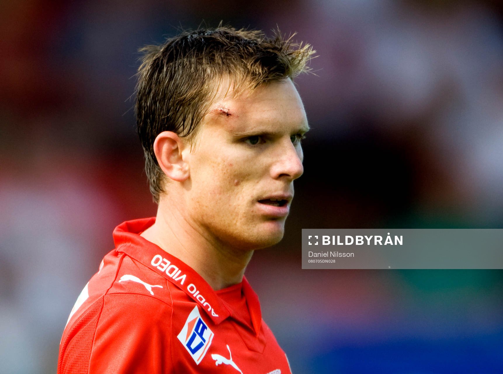 Marcus Lindberg, Kalmar, skada