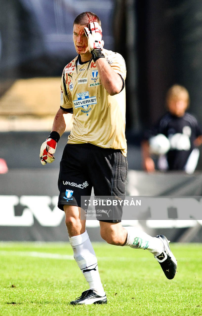 Jonas Sandqvist, målvakt, Malmö, blöder