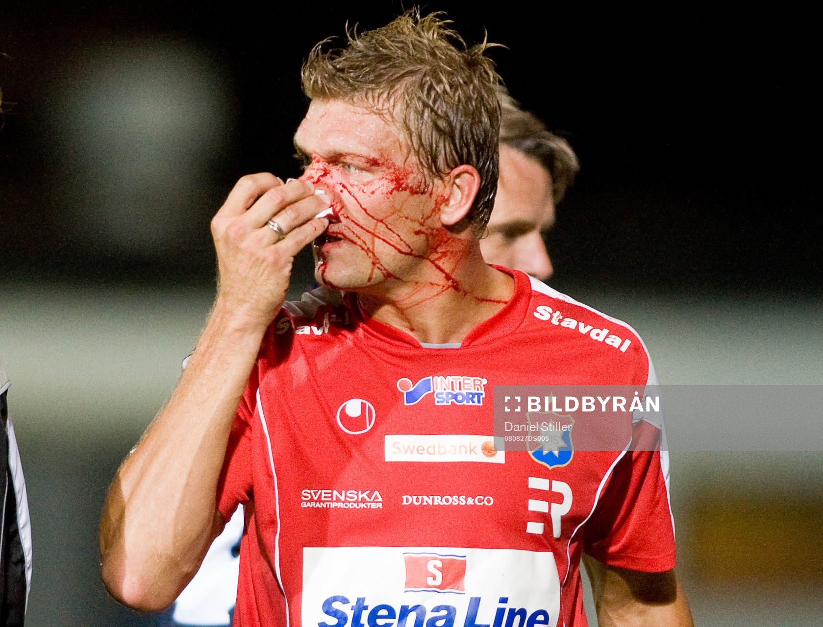 Fotboll, Superettan, Örgryte - Mjällby: Marcus Allbäck skadar näsan i en nickduell och får utgå. 