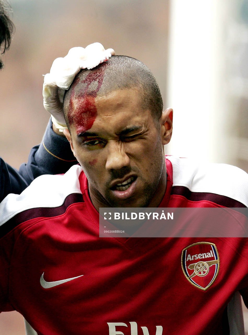 Gael Clichy, Arsenal, huvudskada, skada, blod