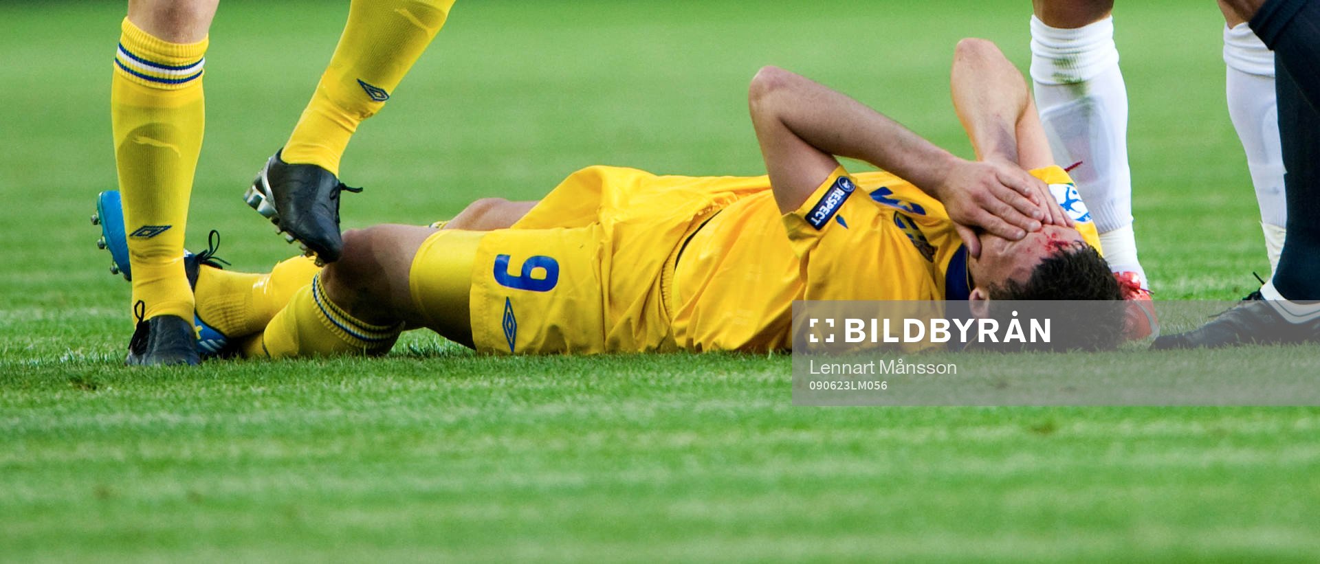 Marcus Berg blodig, skada, blod