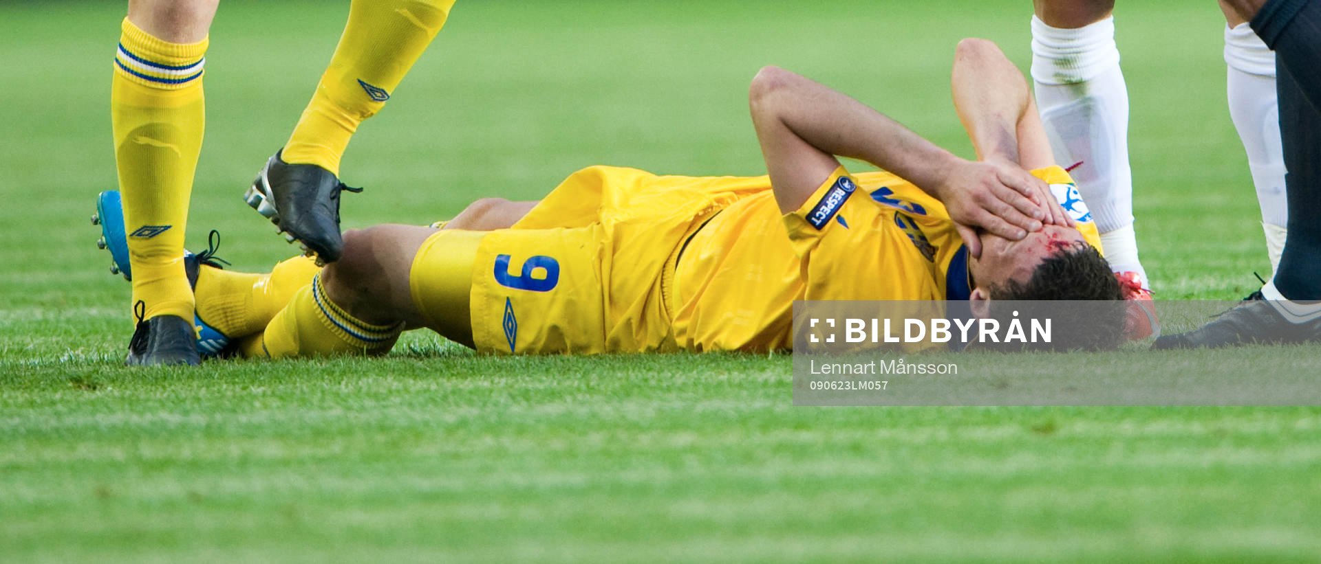 Marcus Berg blodig