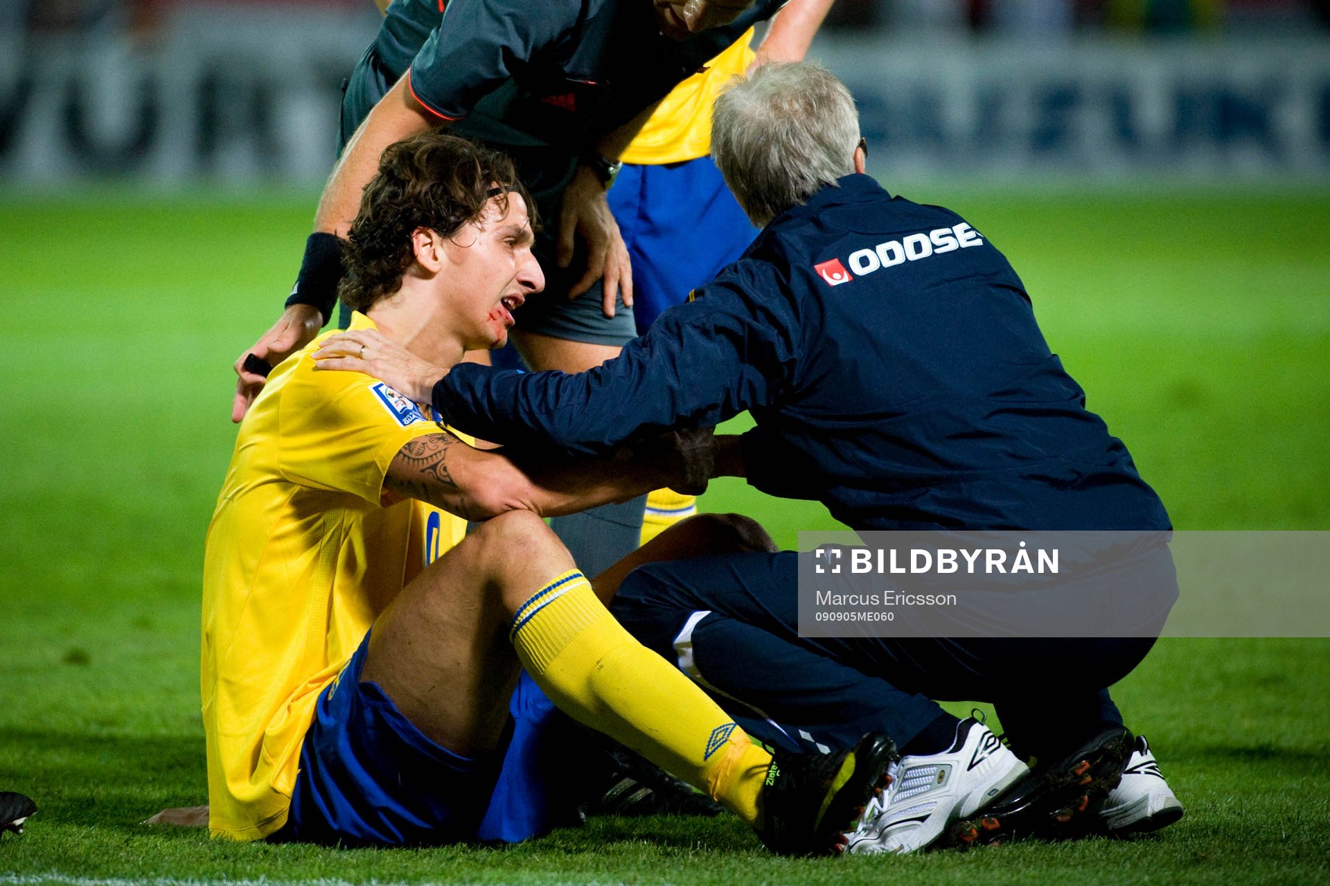 Zlatan Ibrahimovic, Sverige, blodig. Skada, blod