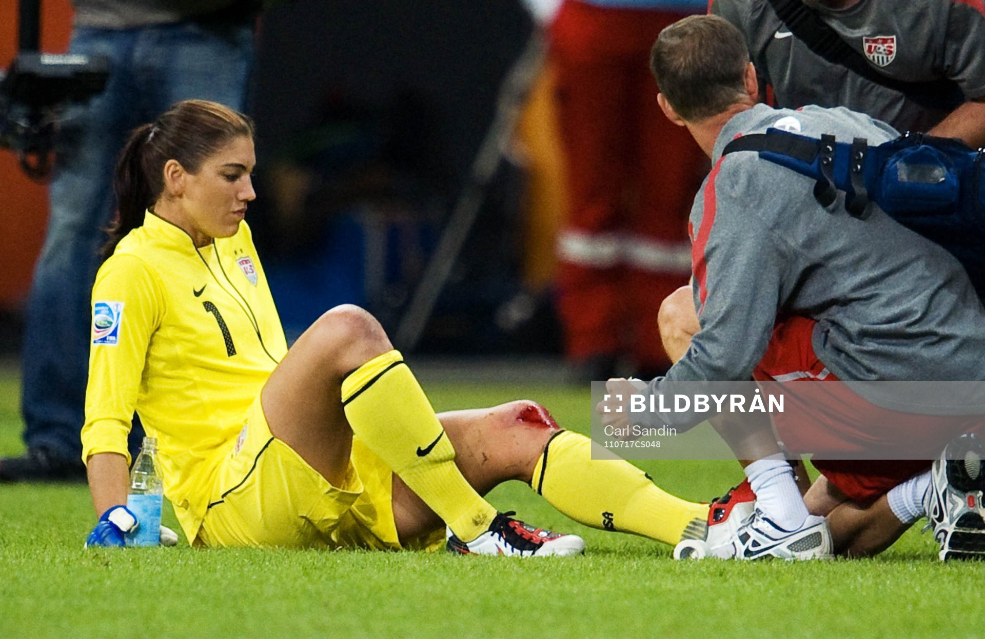 Hope Solo, målvakt, USA, skada