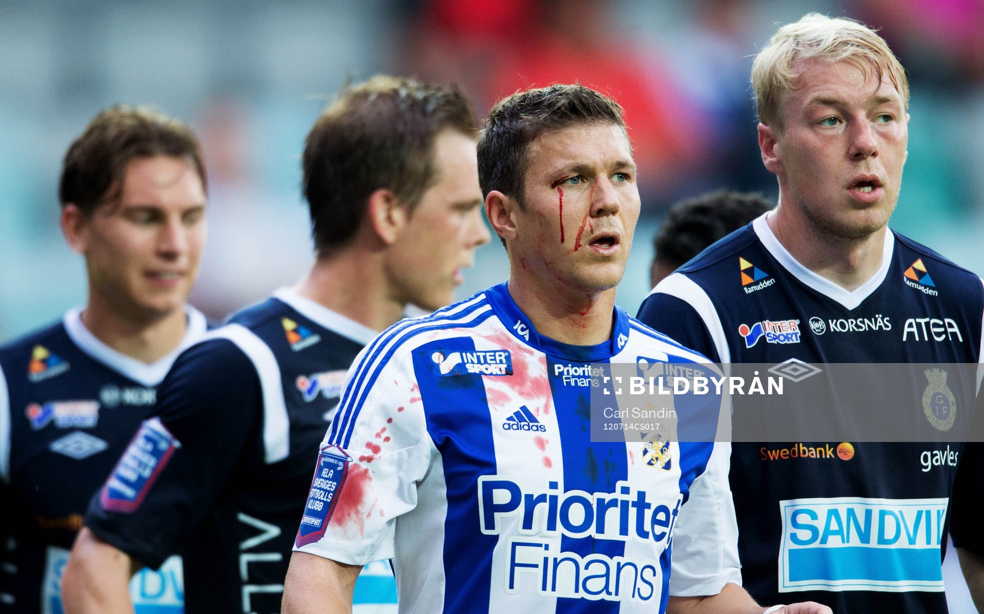 Hannes Stiller, IFK Göteborg, skadad, blod