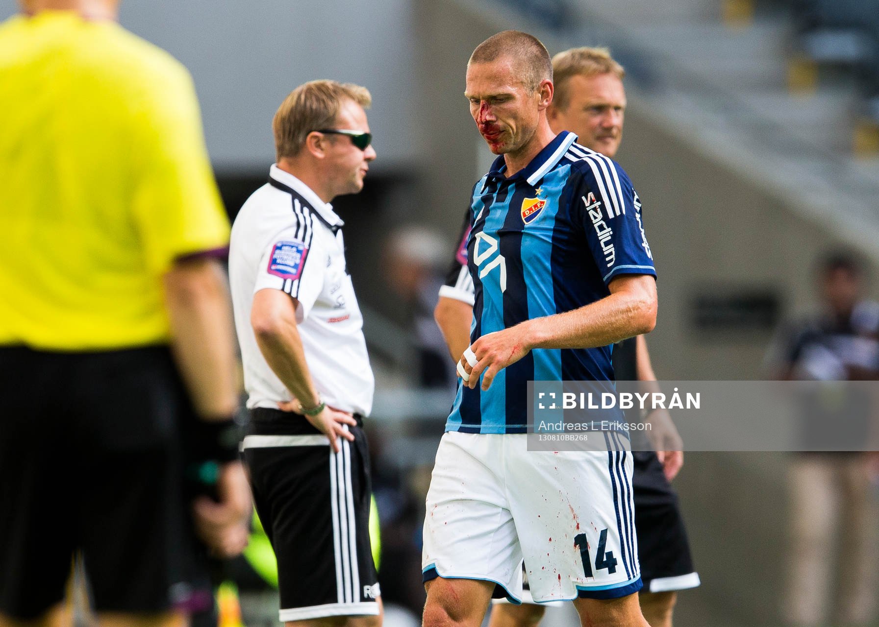 Djurgårdens Mattias Östberg tvingas plåstras om