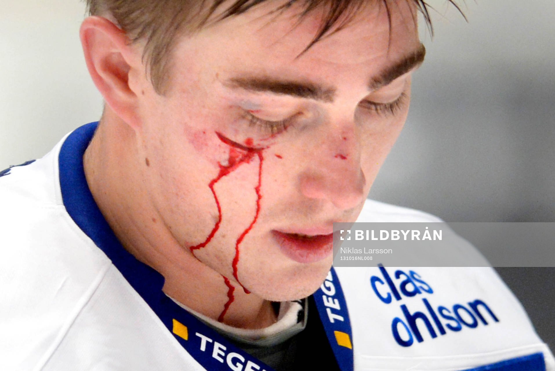 Leksands Tobias Forsberg får ett rejält sår