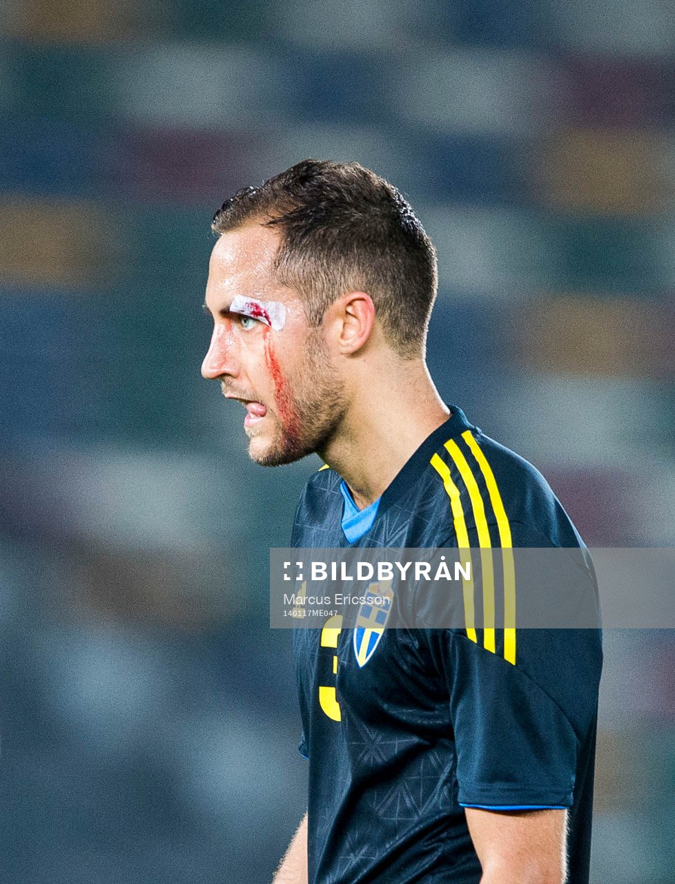 Sveriges Niklas Backman med blödande ögonbryn under träningslandskampen mellan Moldavien och Sverige på januariturnén den 17 januari 2014 i Abu Dhabi.