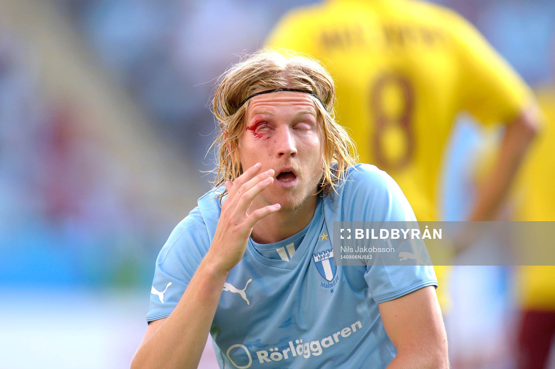 Malmö FFs Simon Kroon blöder från ögonlocket