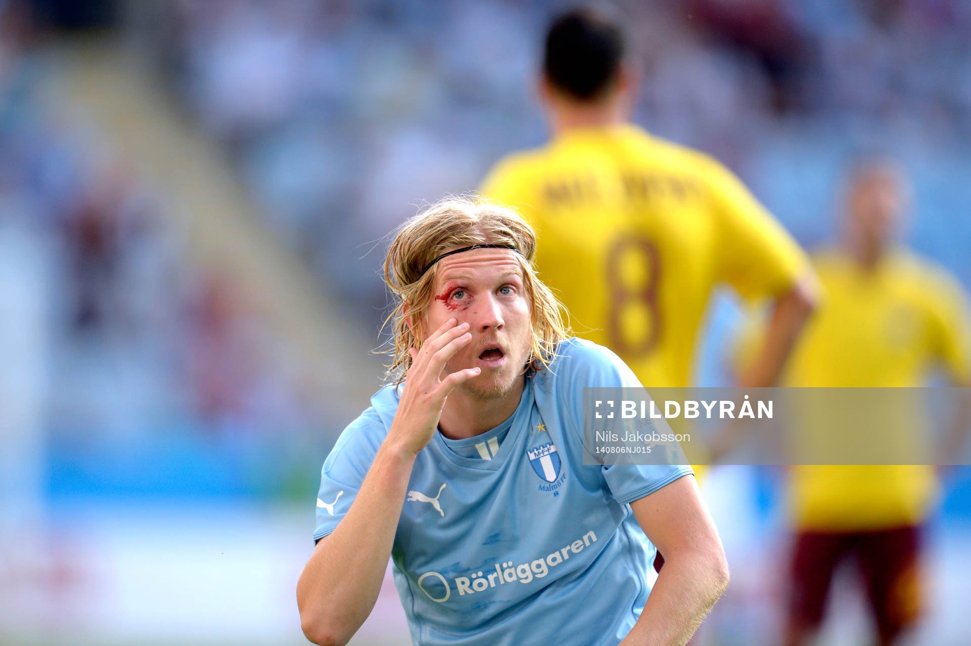 Malmö FFs Simon Kroon blöder från ögonlocket