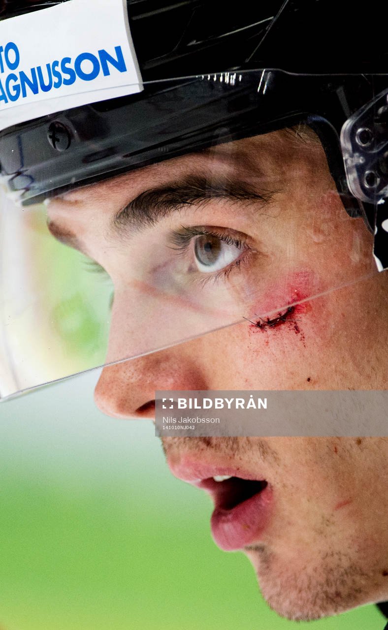 Malmö Redhawks Henrik Hetta fick en klubba i ansiktet och