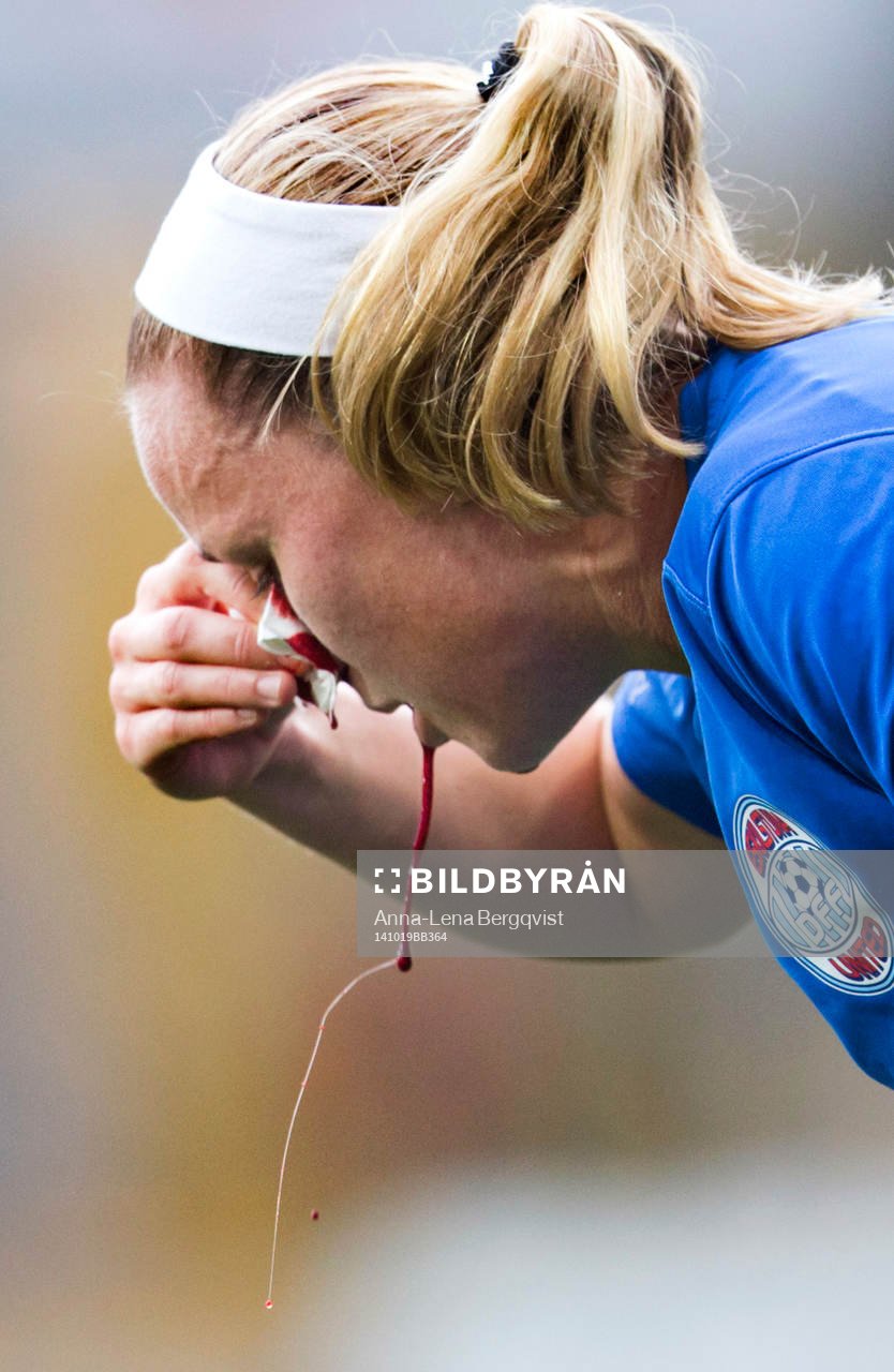 Eskilstunas Sara Thunebro blöder