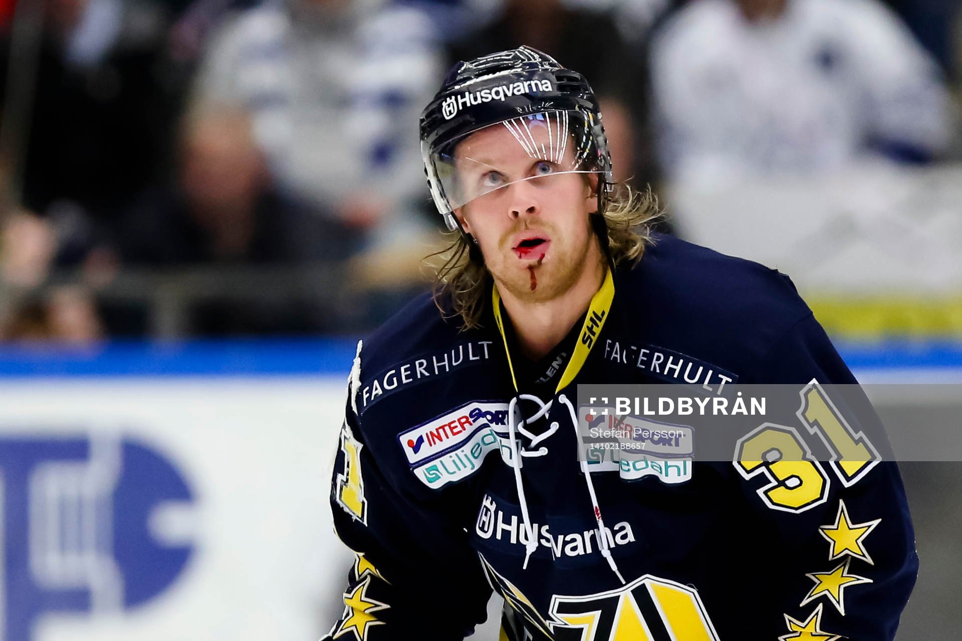 s Mattias Tedenby blöder i ansiktet