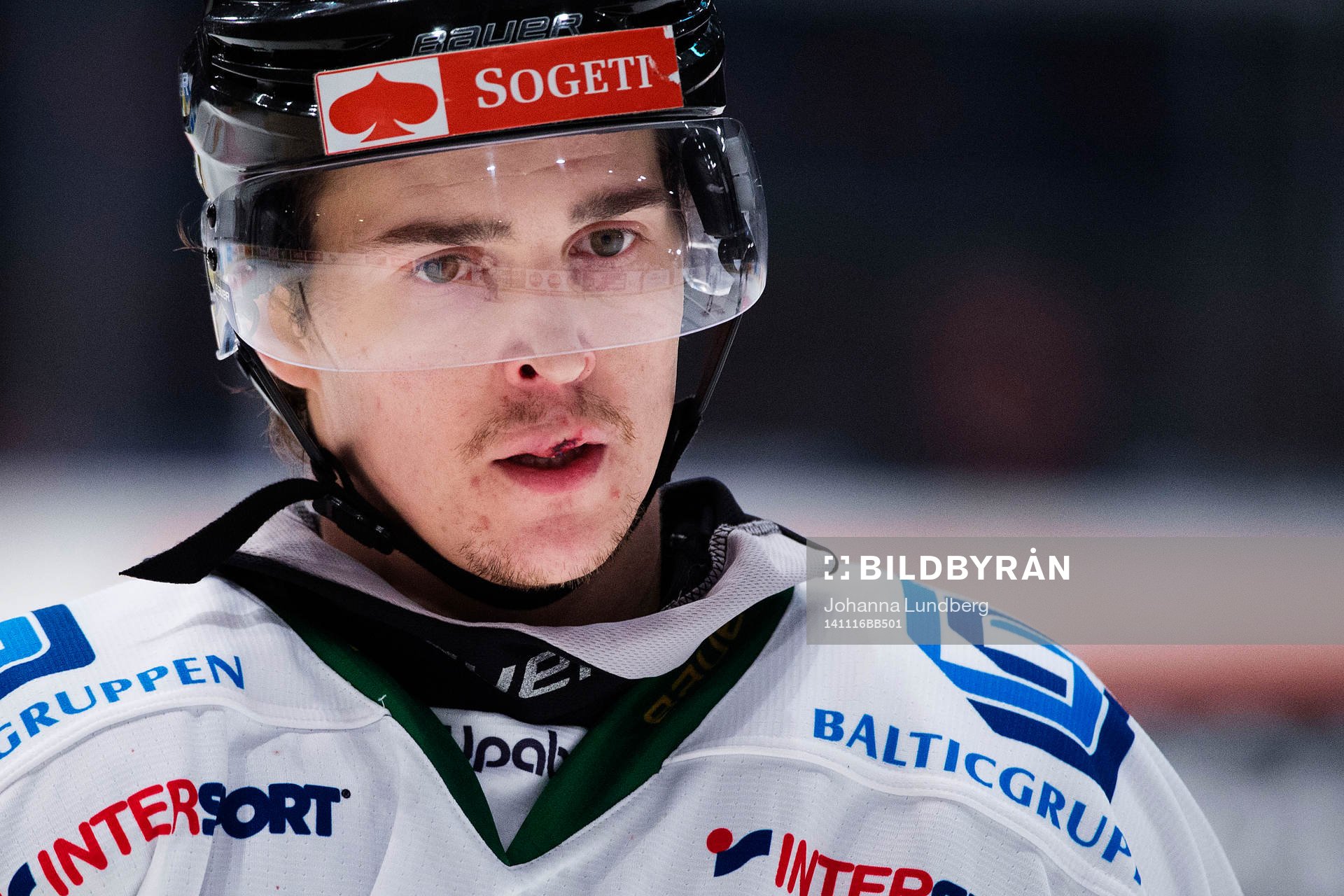 Björklövens Tommy Wargh med sydd läpp