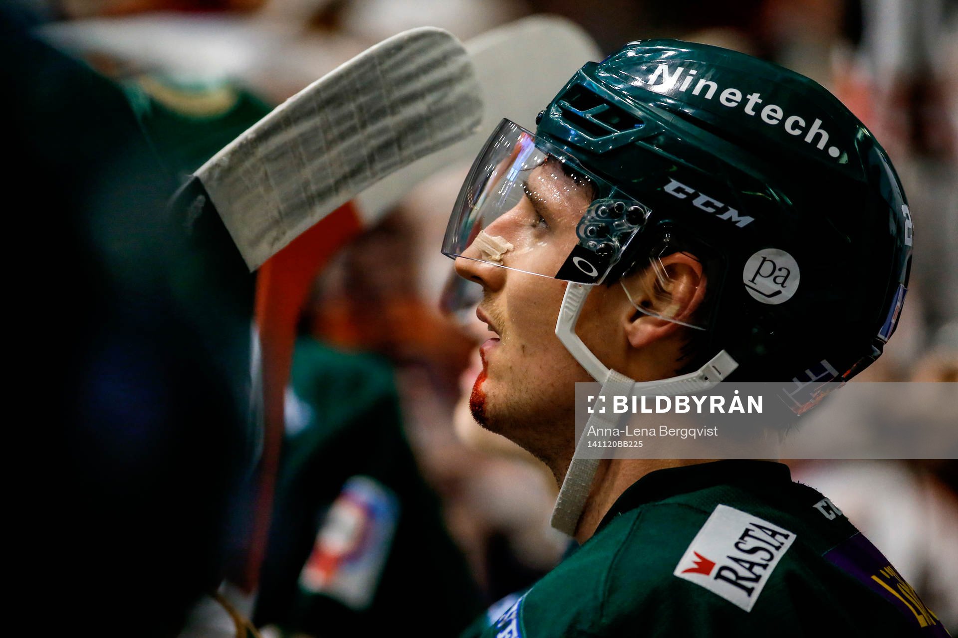 Färjestads Anton Hedman fick pucken på hakan och blöder