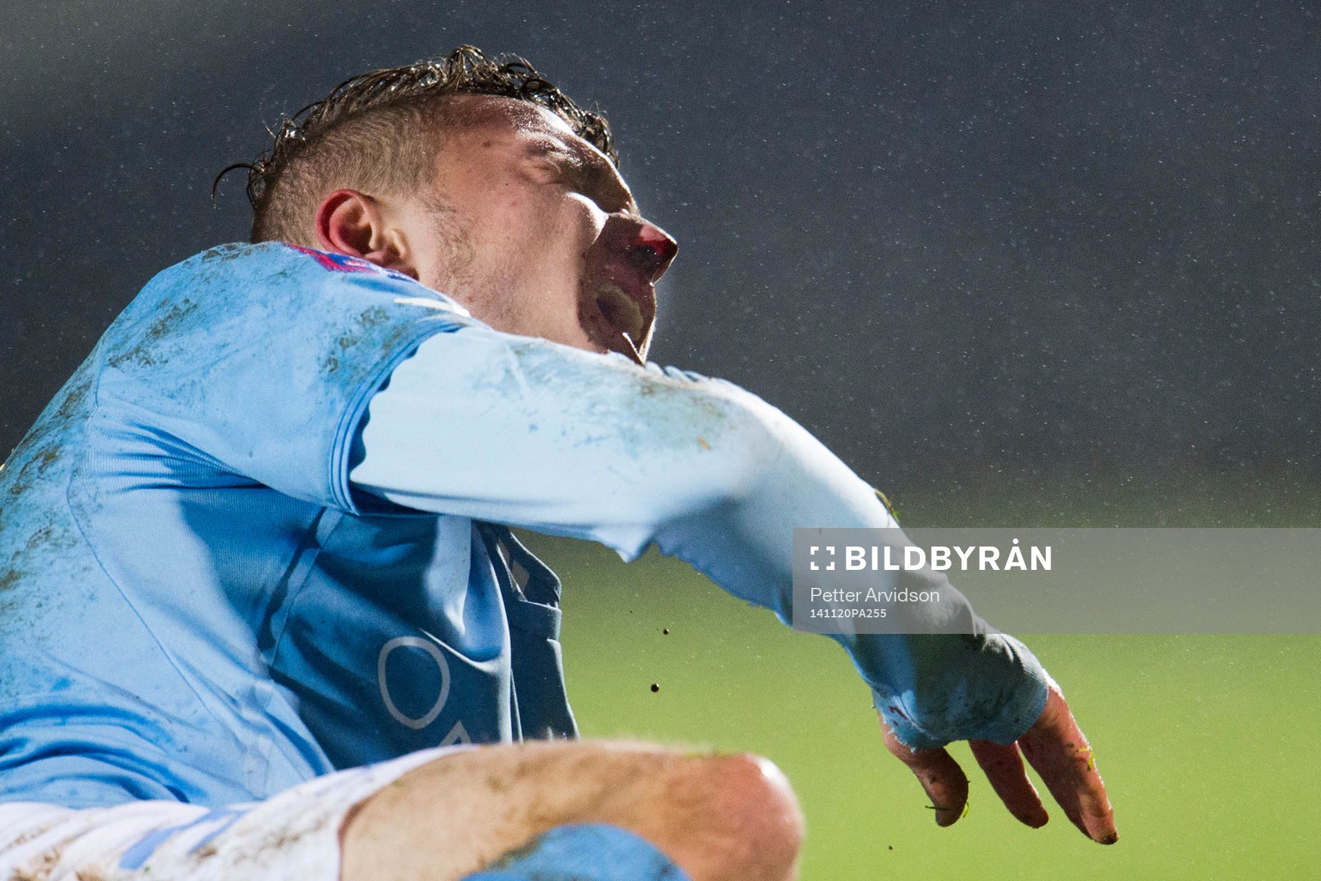 Malmö FFs Piotr Johansson har fått en smäll på näsan