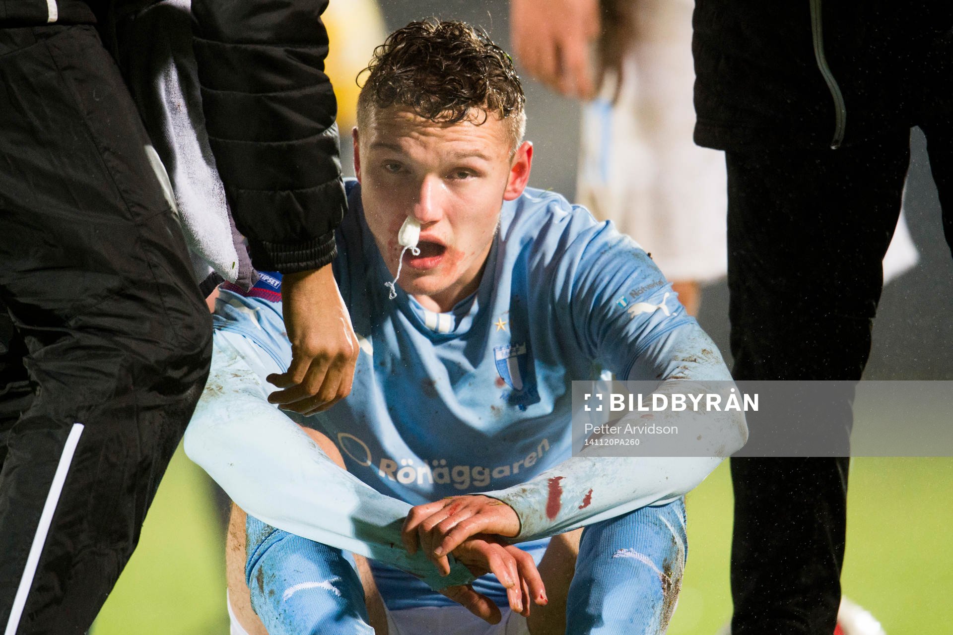 Malmö FFs Piotr Johansson har fått en smäll på näsan