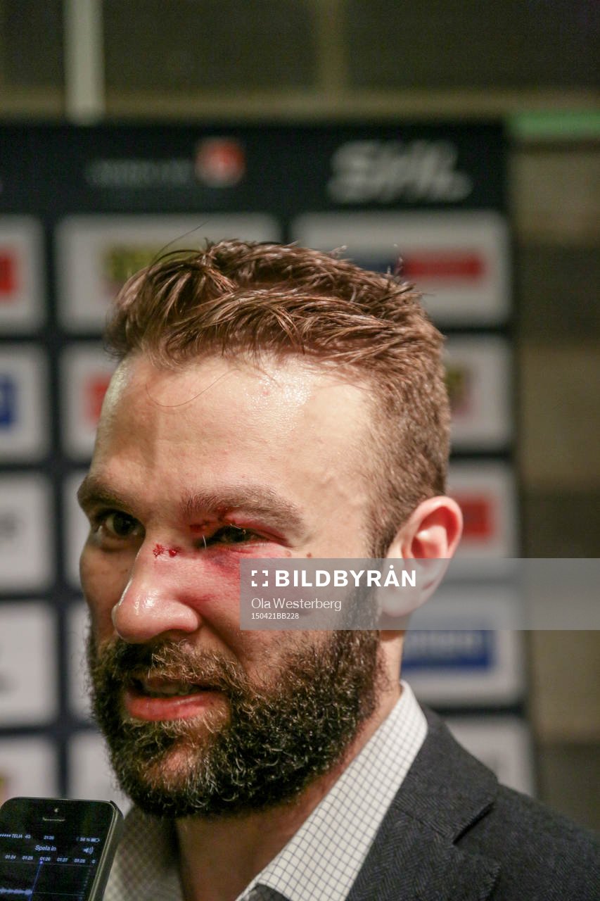Växjös Josh Hennessy med svullet öga