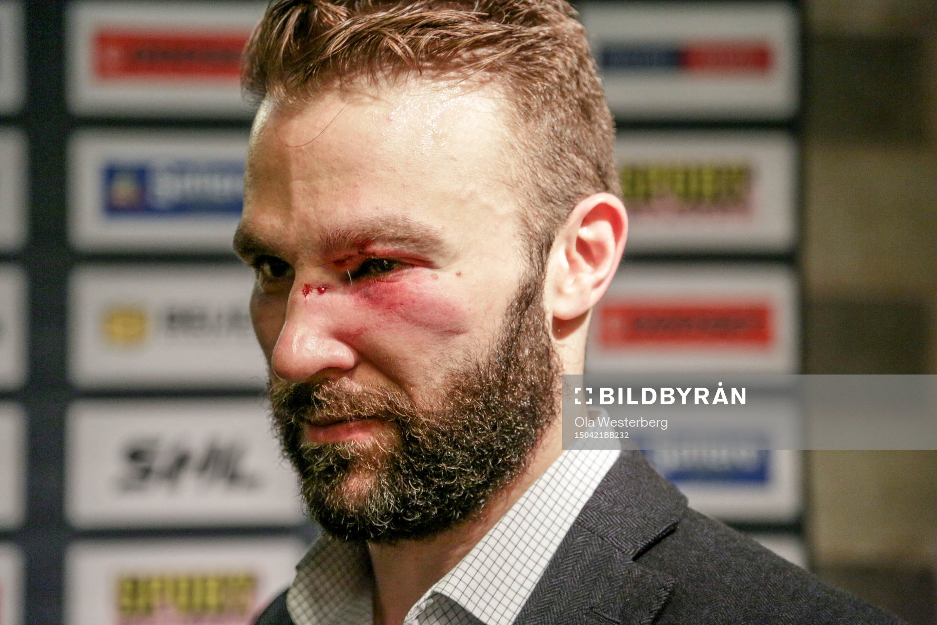 Växjös Josh Hennessy med svullet öga