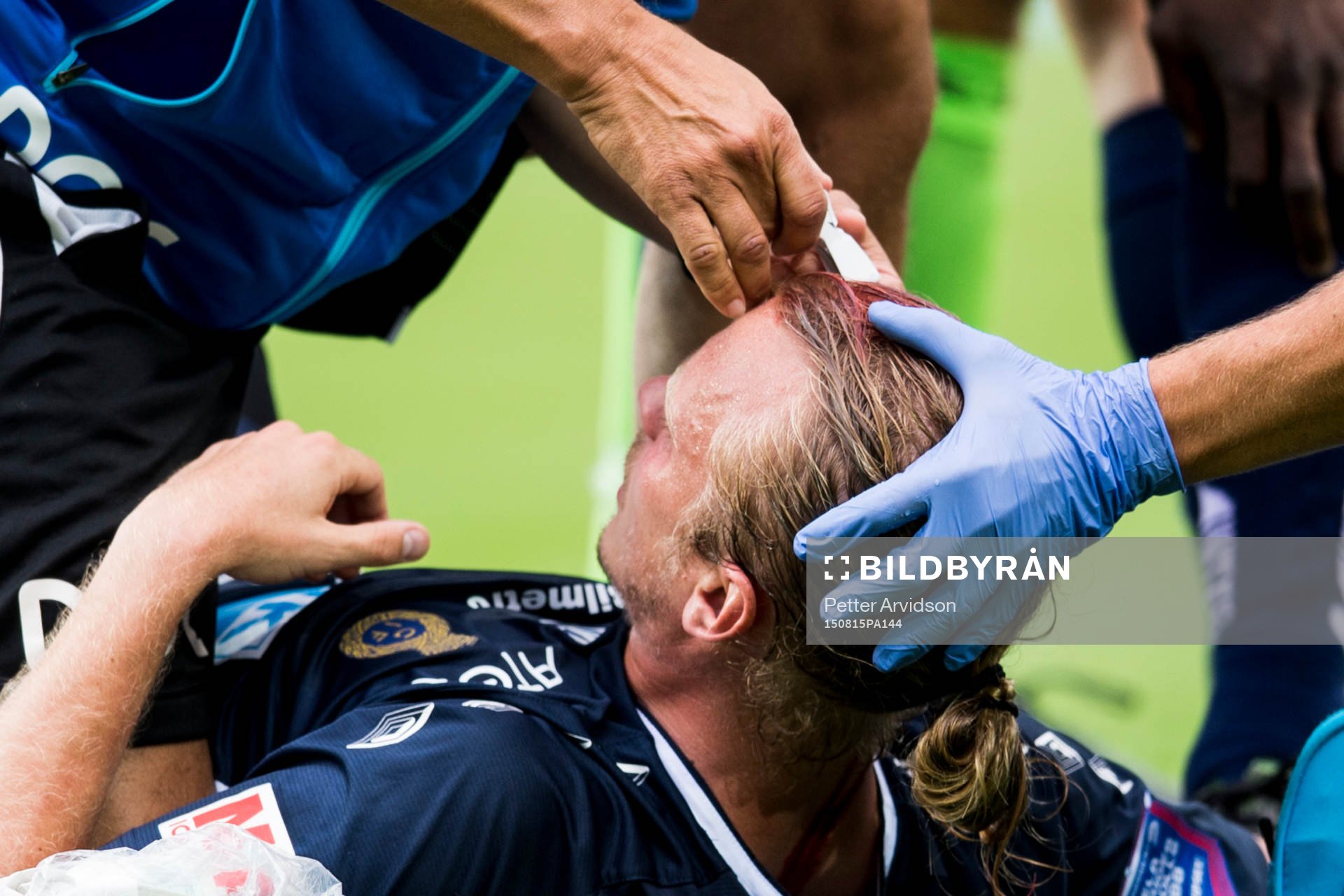 Gefles Jesper Florén skadades otäckt i pannan