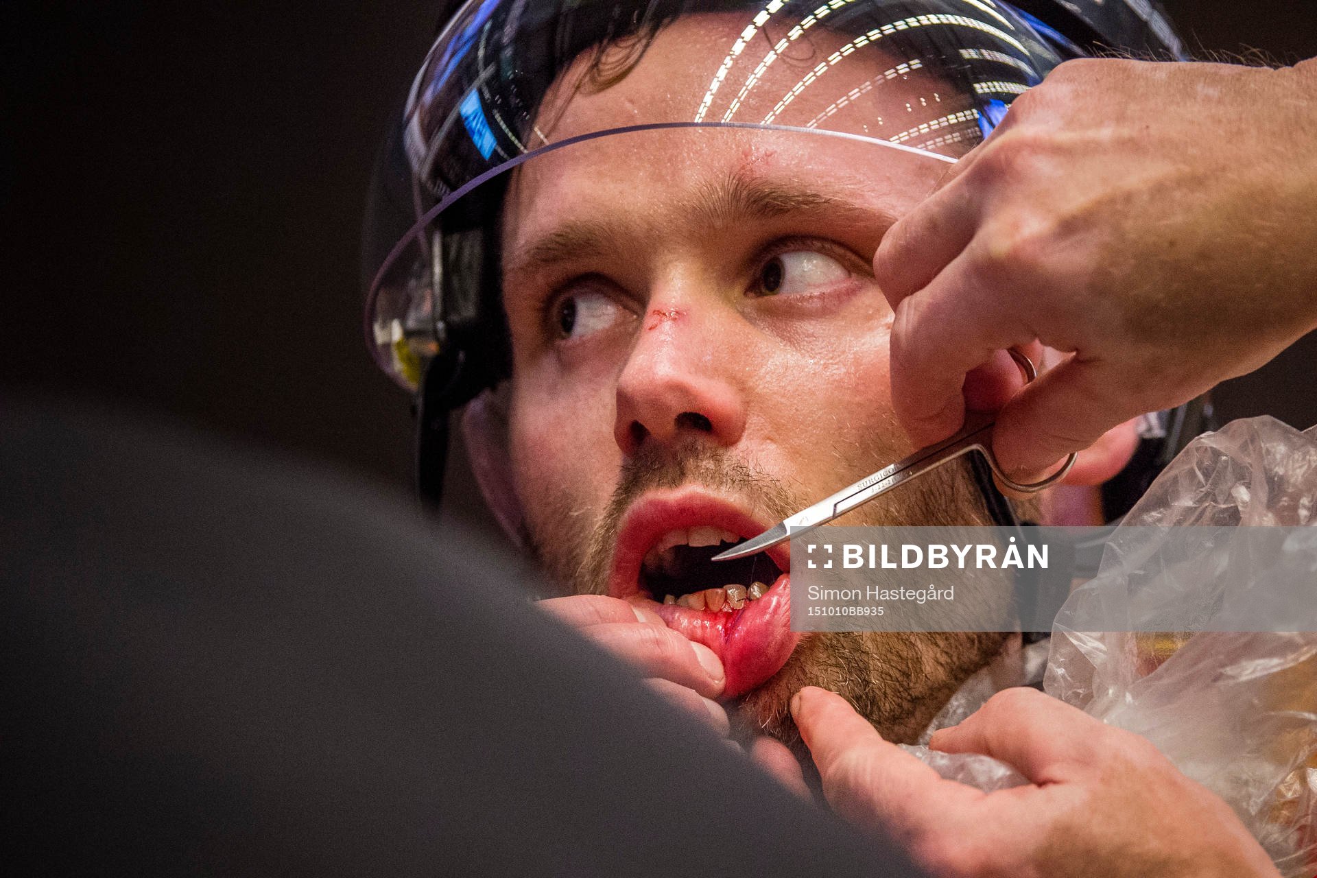 Brynäs Jesper Ollas blir sydd i läppen