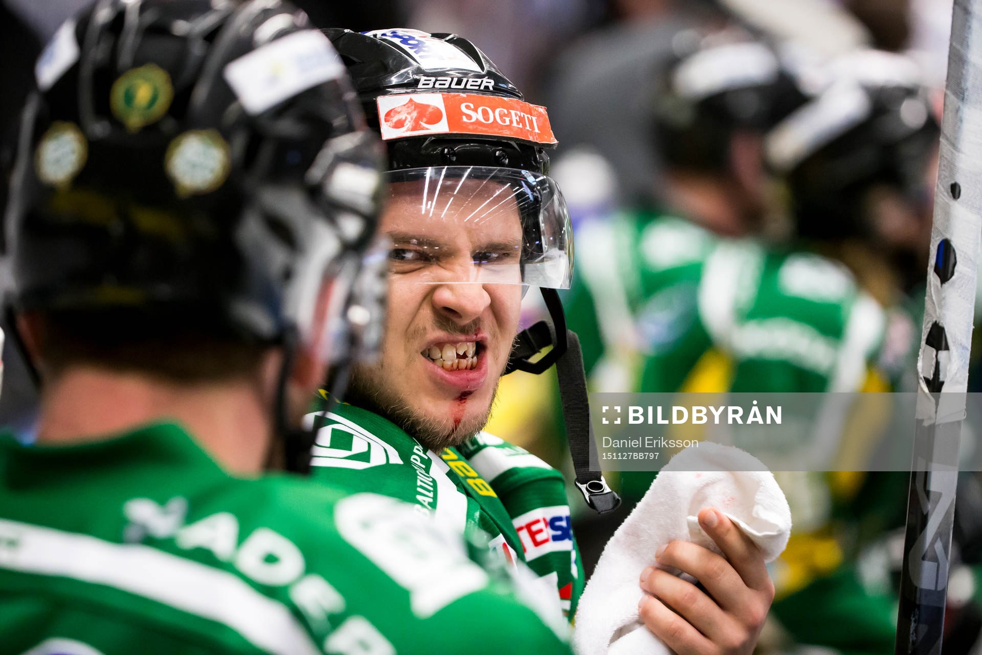 Björklövens Lucas Sandström har fått tanden utslagen