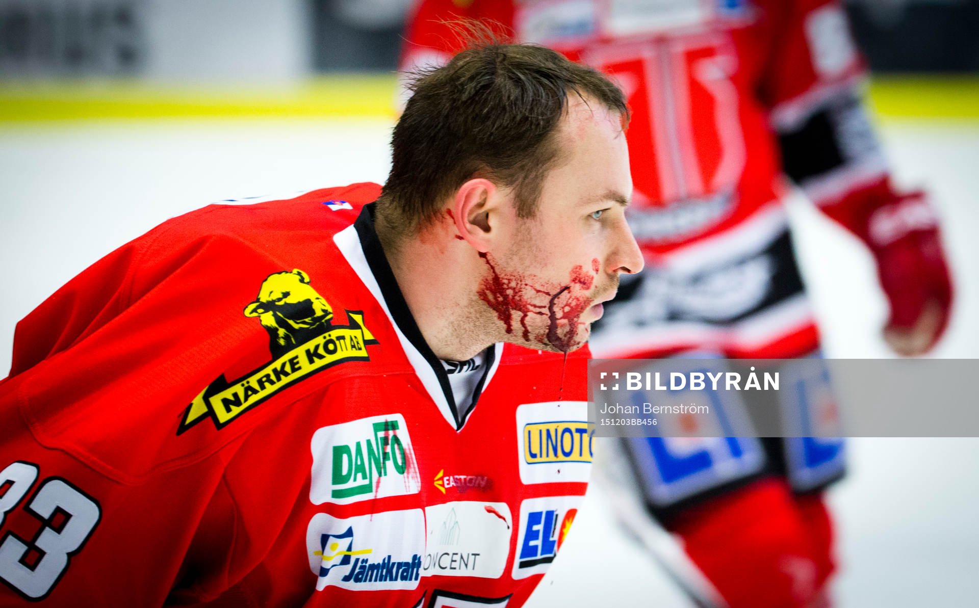Örebros målvakt Julius Hudacek blöder