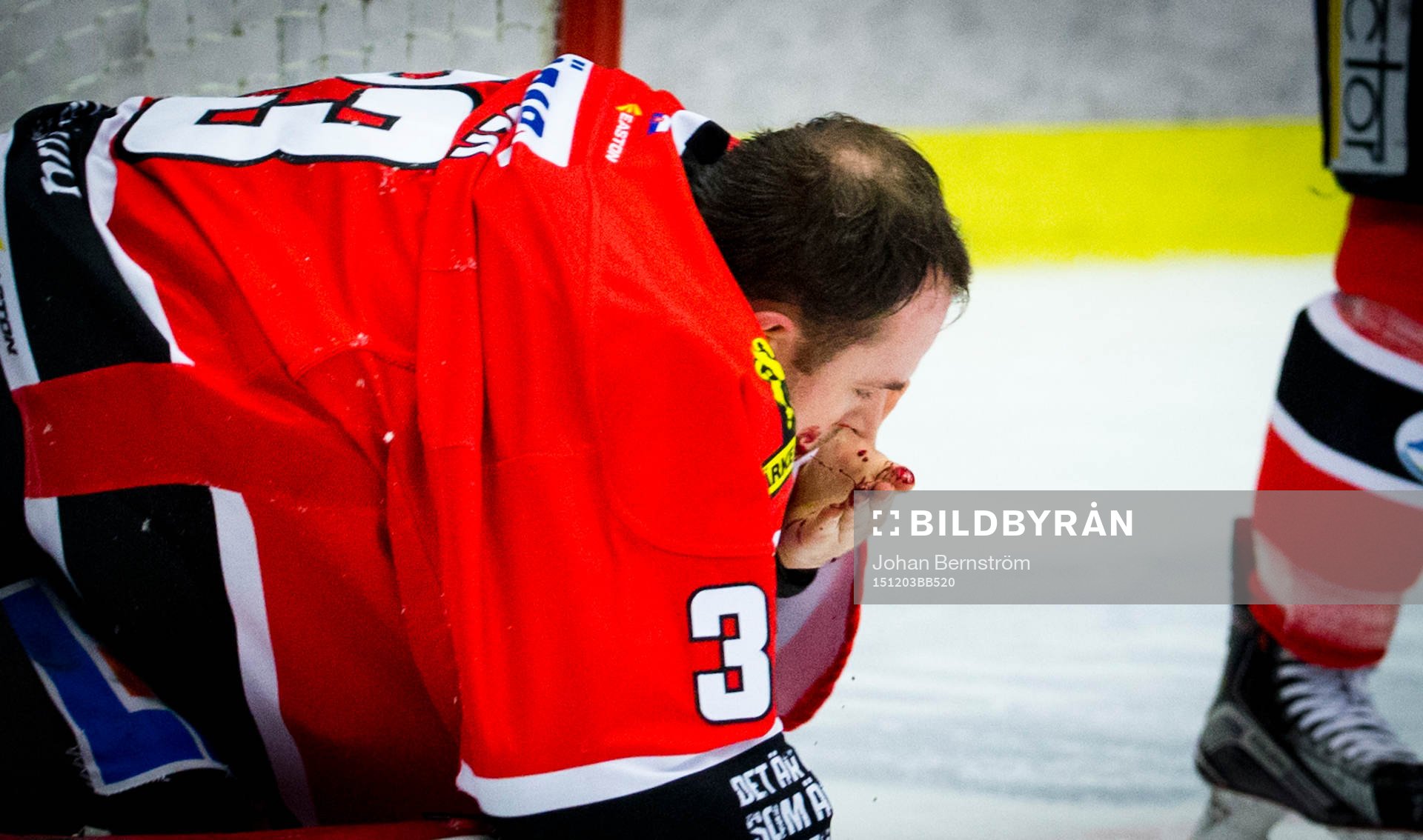 Örebros målvakt Julius Hudacek blöder