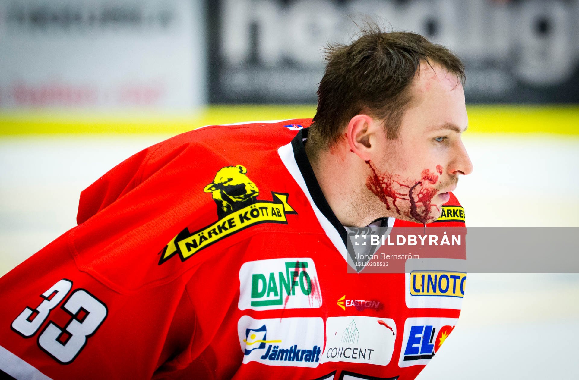 Örebros målvakt Julius Hudacek blöder
