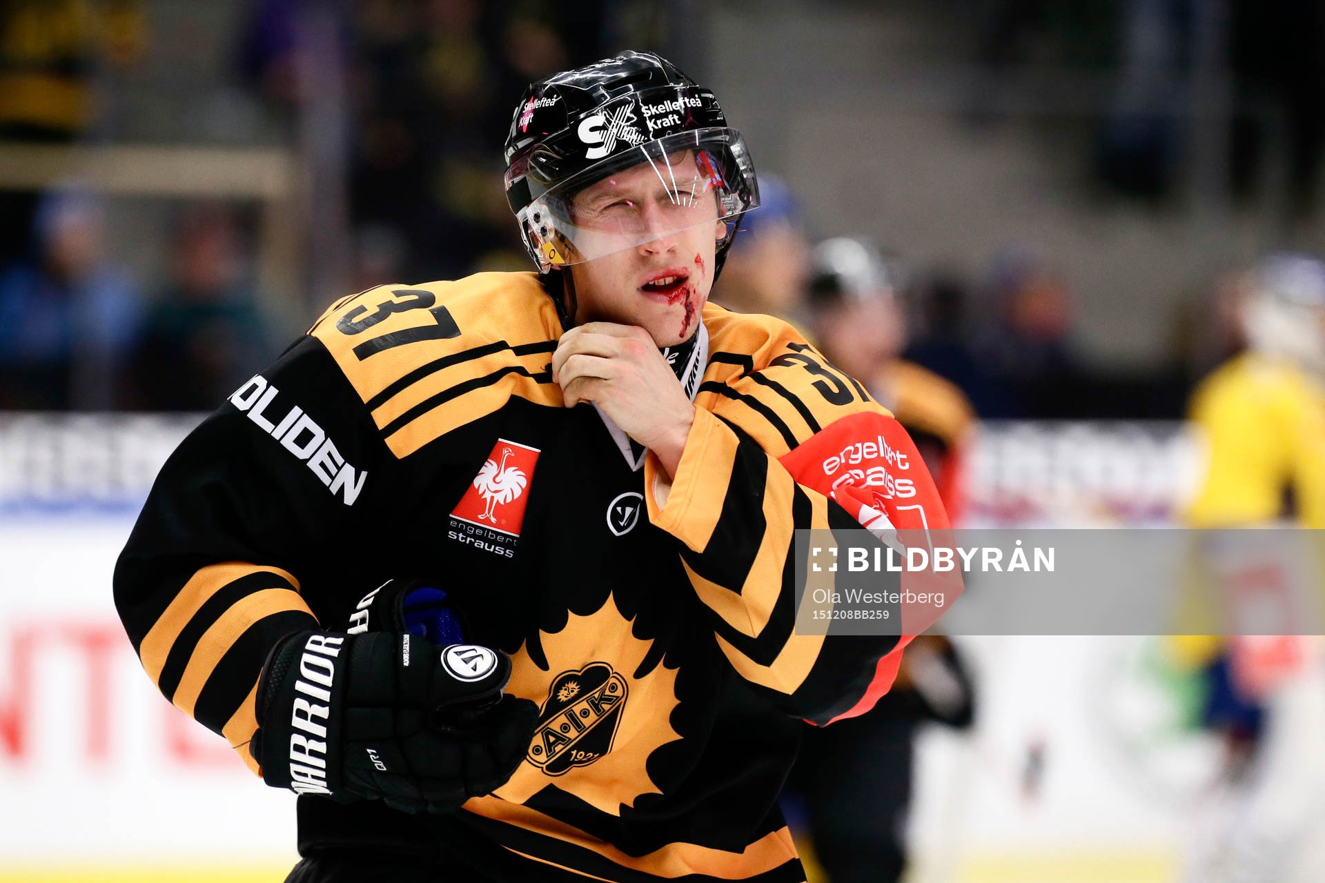 Skellefteås John Norman skadar sig