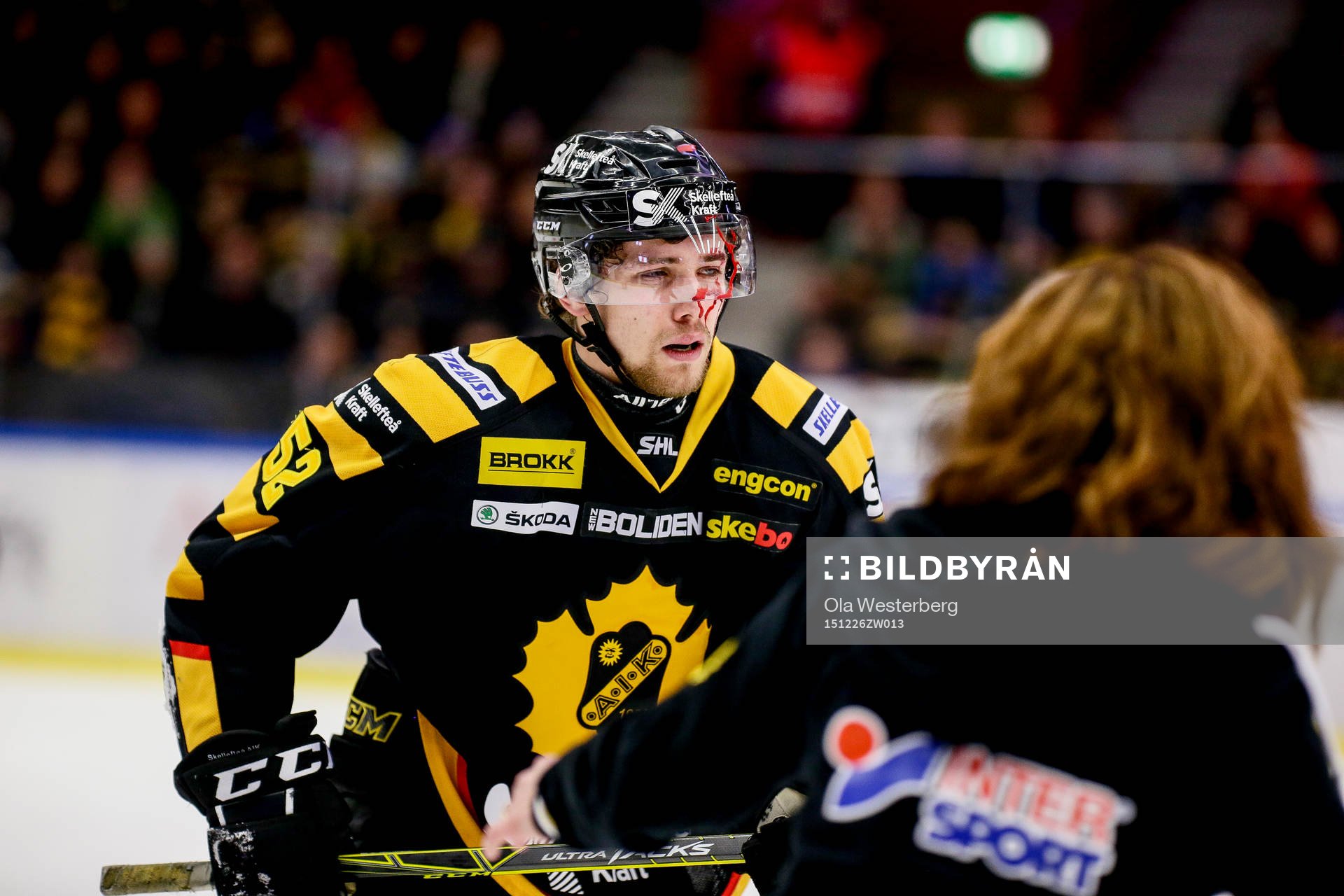 Skellefteås Arvid Lundberg fick en puck i ansiktet och