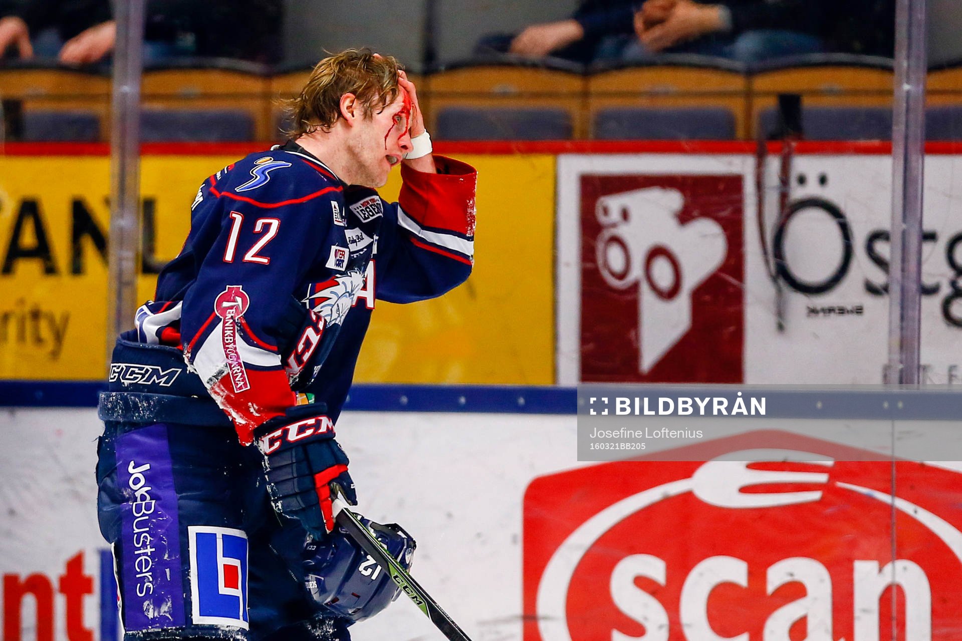 Linköpings Sebastian Karlsson blöder från huvudet