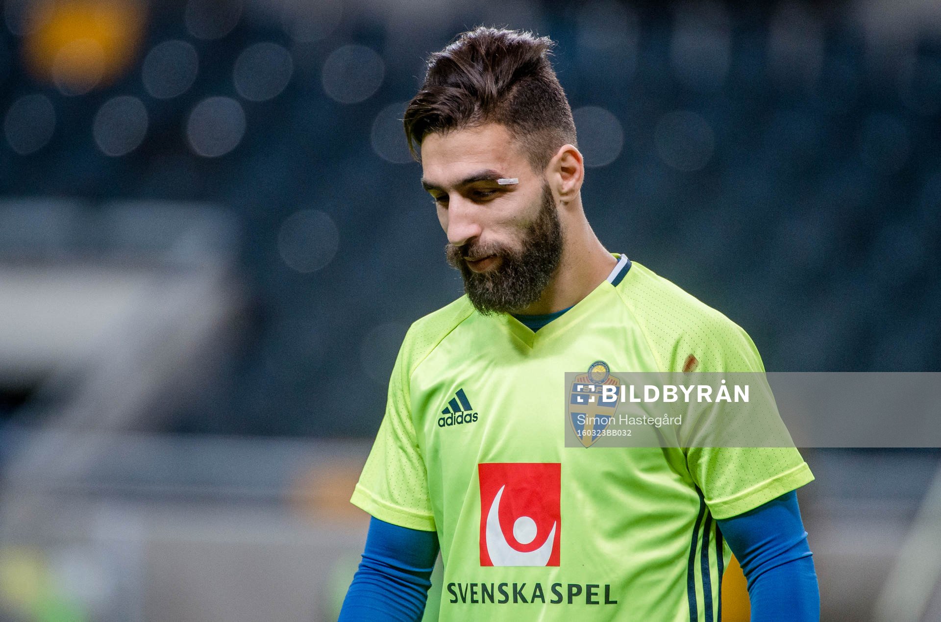 Jimmy Durmaz omplåstrad
