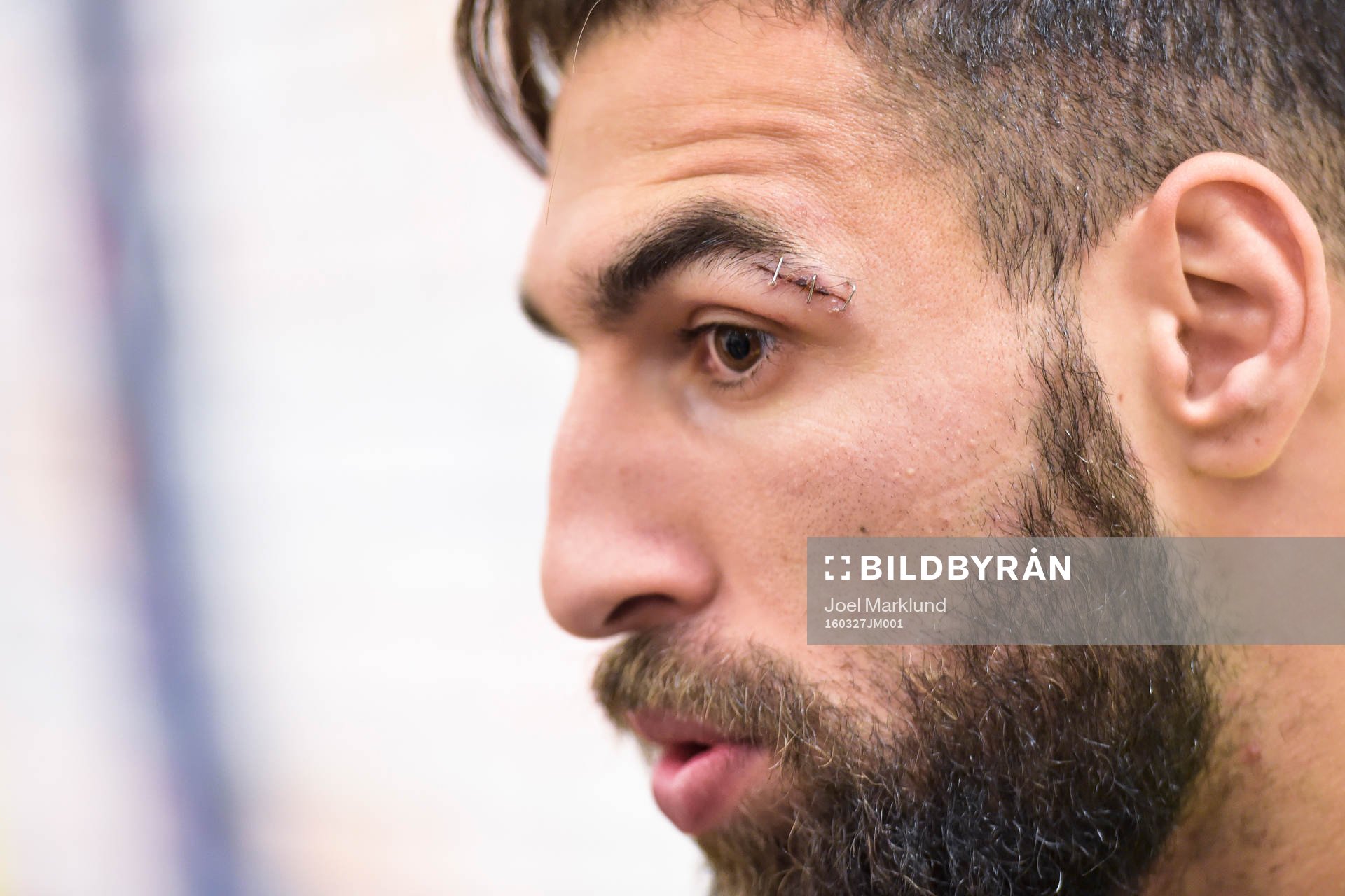 Jimmy Durmaz med häftat sår i ansiktet före Sveriges