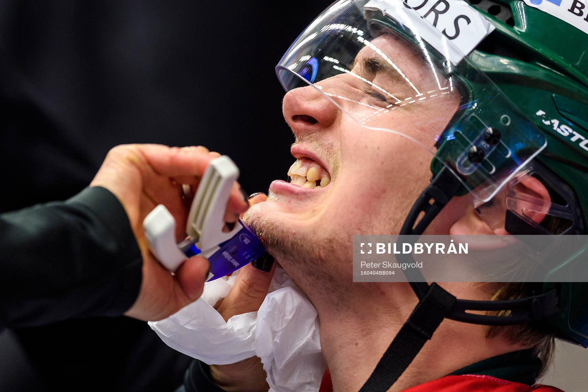 Frölundas Johan Sundström grinar illa när han får sin