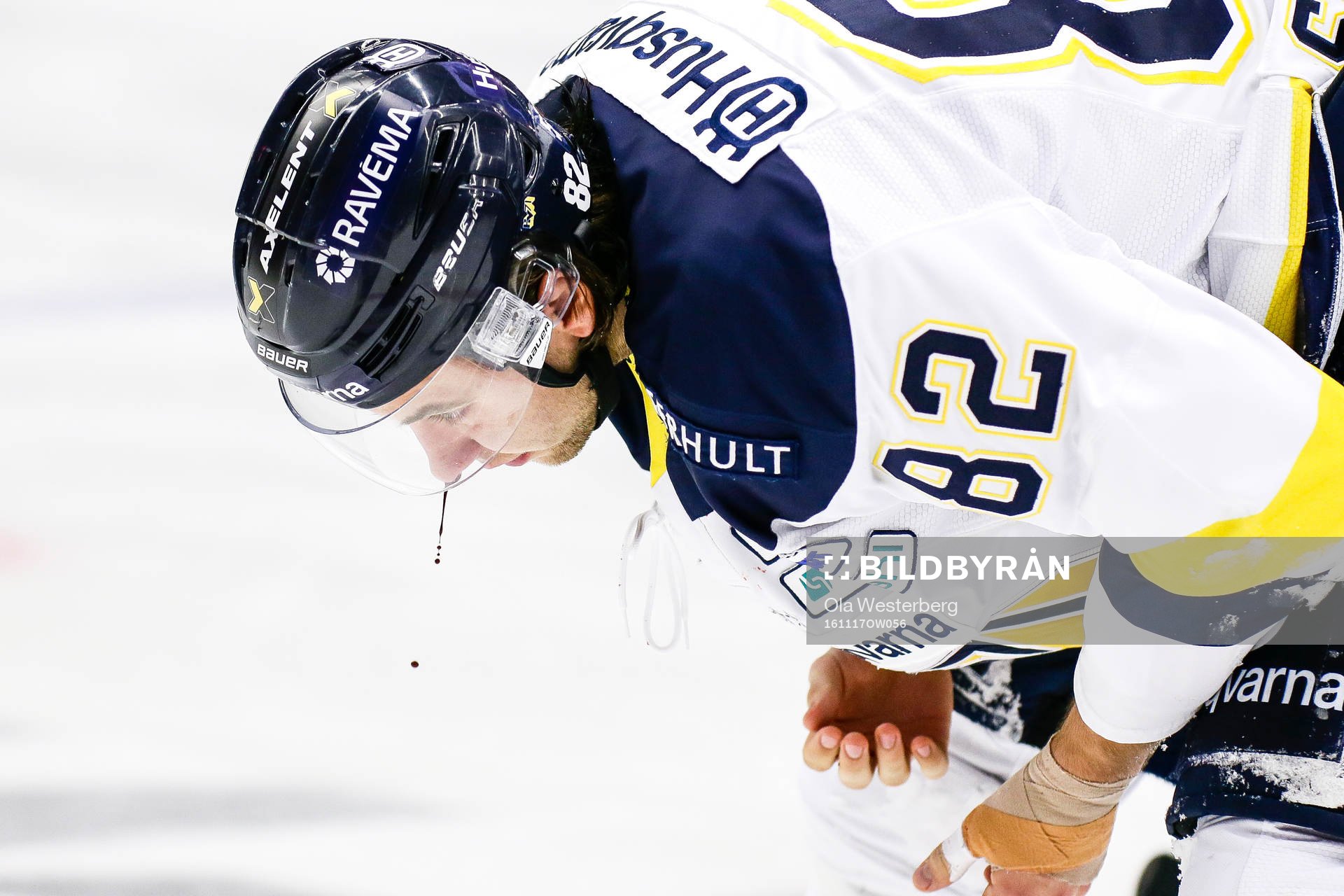 Hv71s  Kevin Stenlund blödde i ansiktet