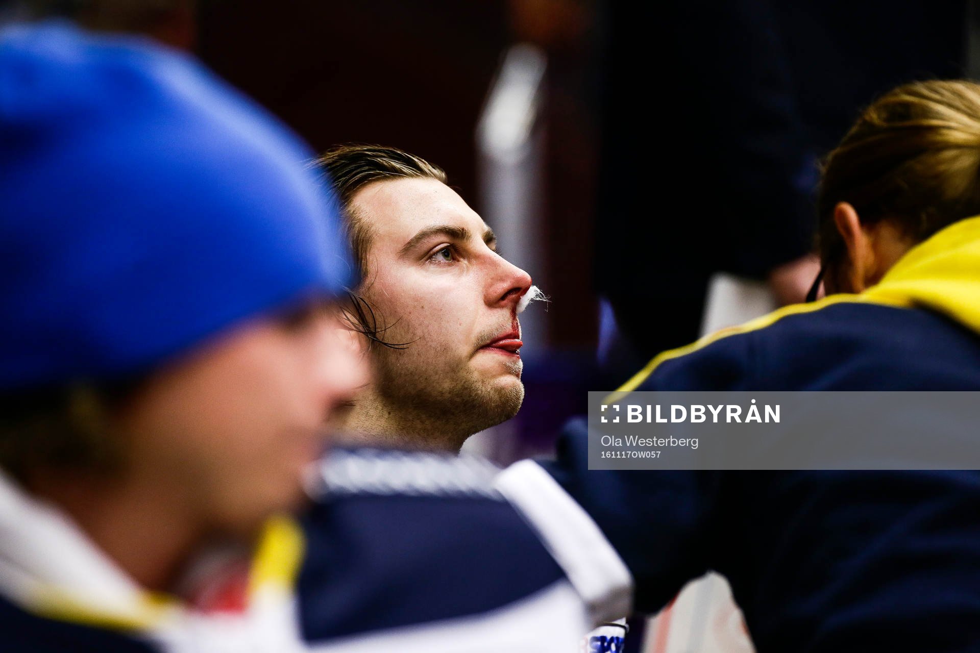 Hv71s  Kevin Stenlund blödde i ansiktet