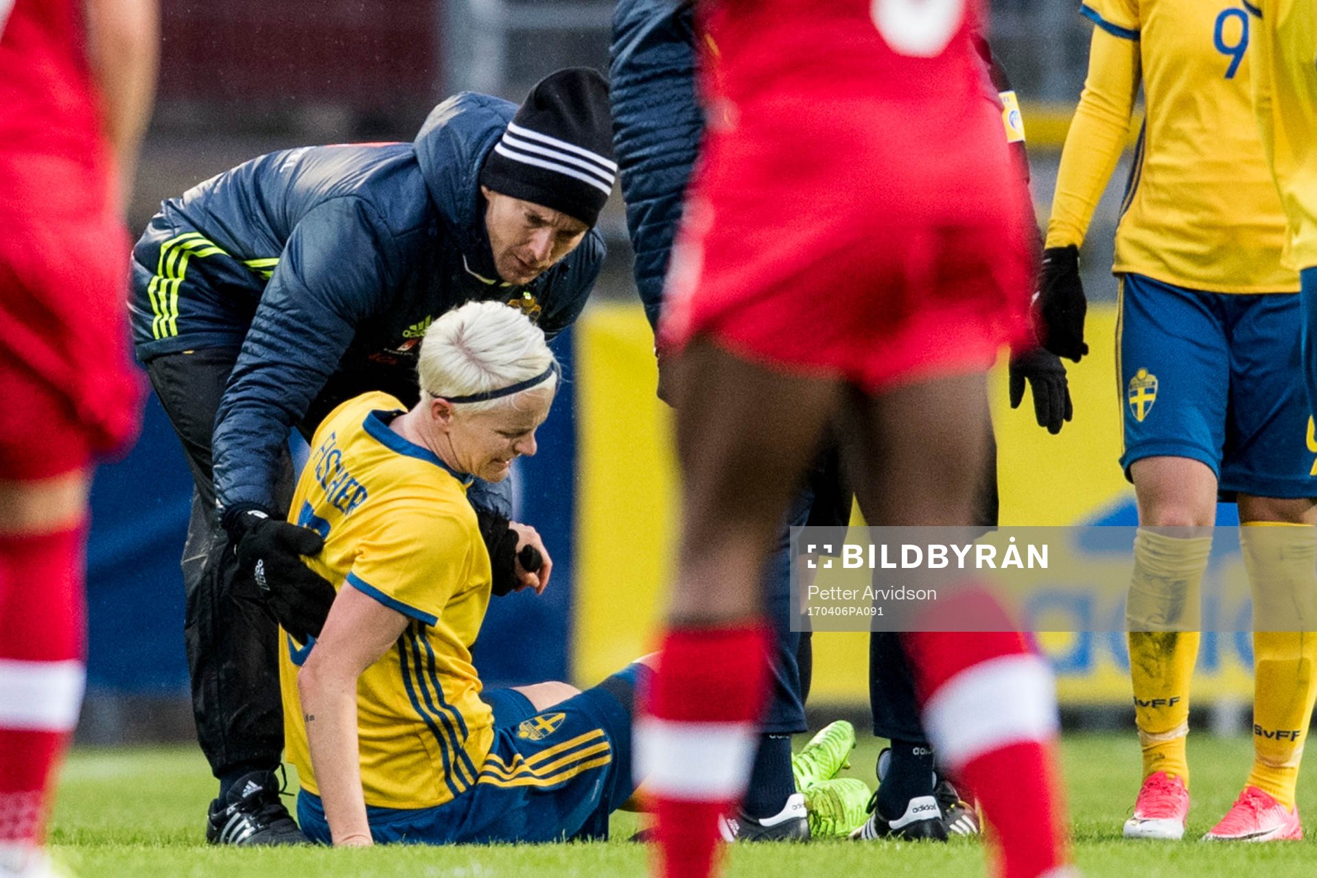 Sveriges Nilla Fischer tvingas till byte