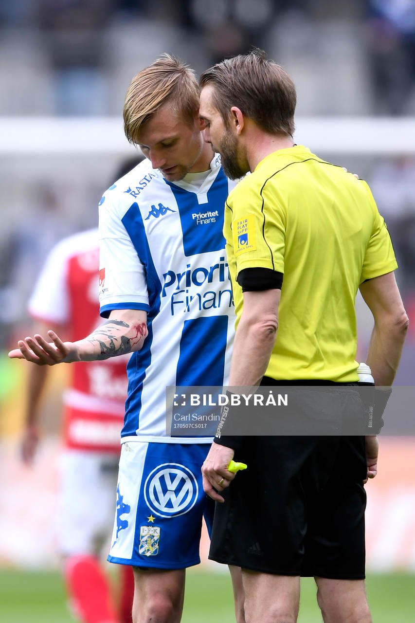 IFK Göteborgs Sebastian Eriksson visar upp sin blödande