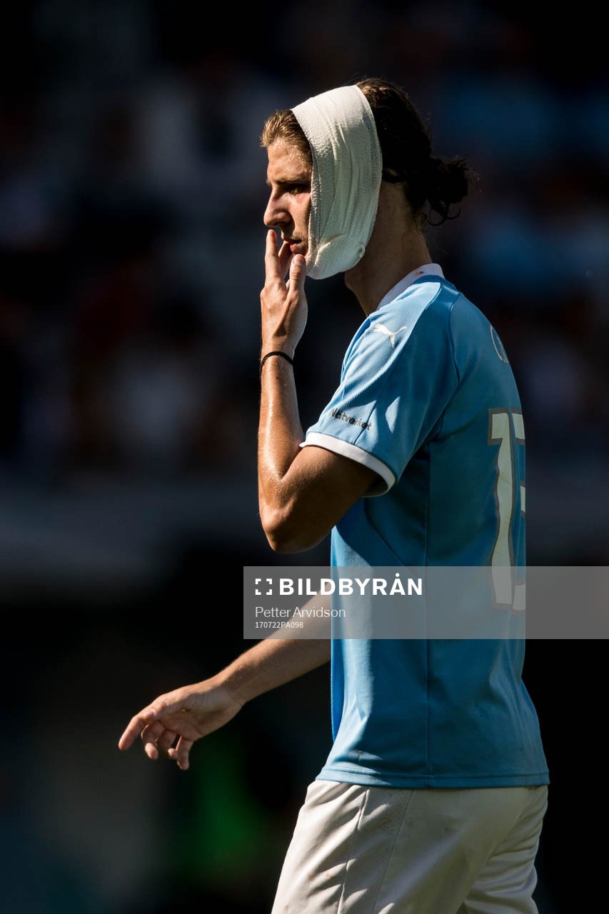Malmö FFs Pawel Cibicki med lindat huvud