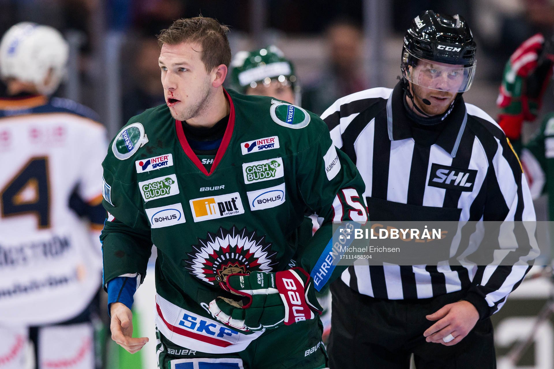 Frölundas Matt Donovan med blodig näsa