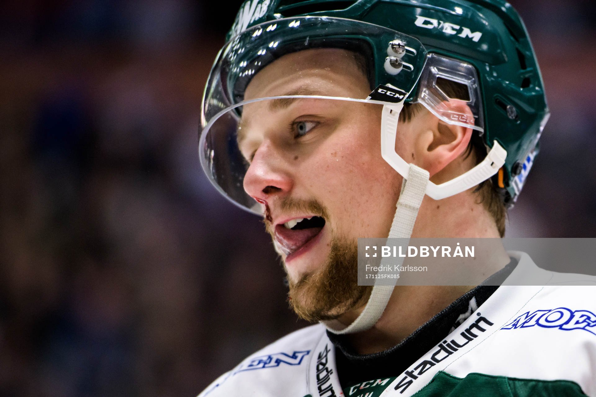 Färjestads Rasmus Asplund blöder från näsan
