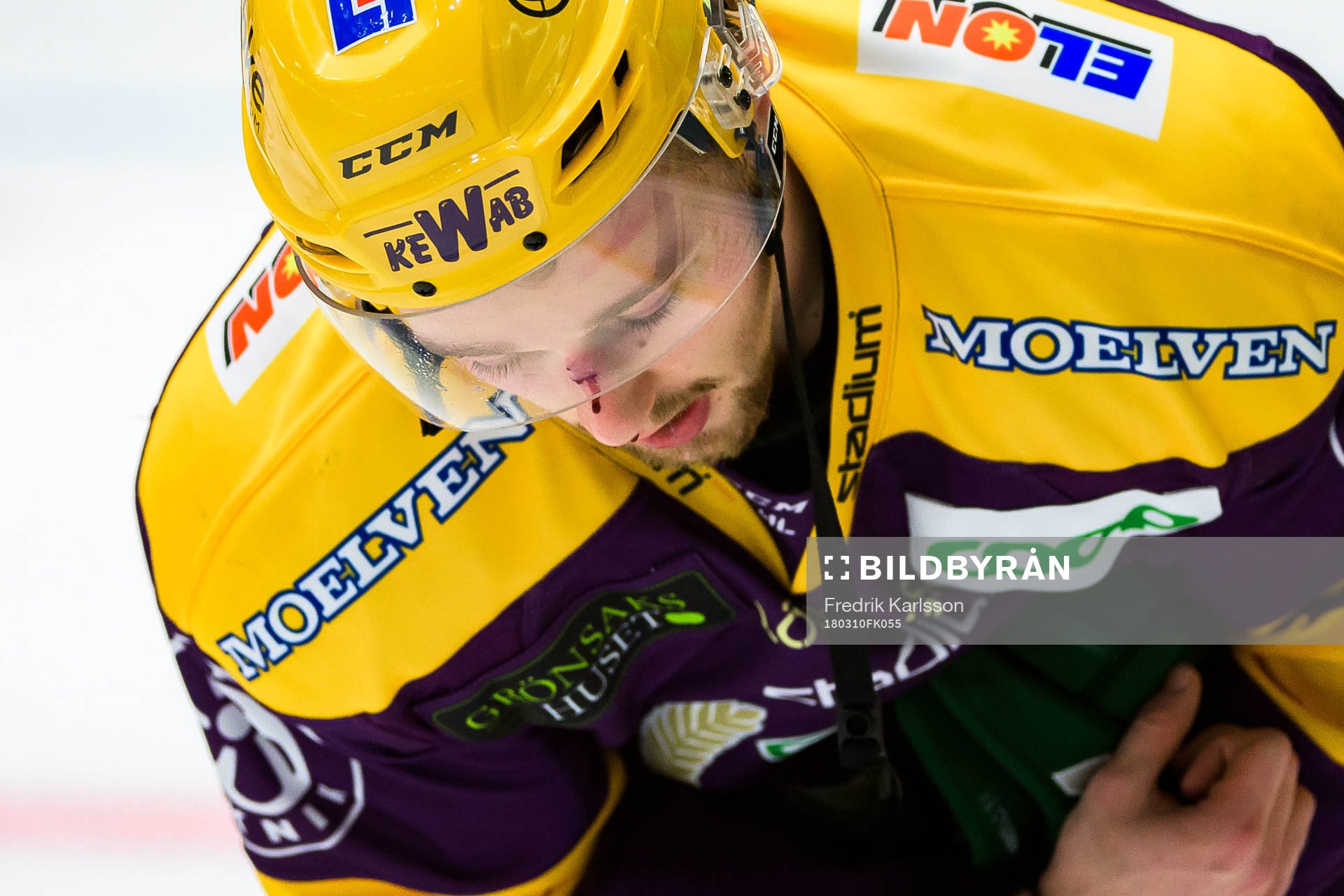 Färjestads Rasmus Asplund har fått en puck i ansiktet och