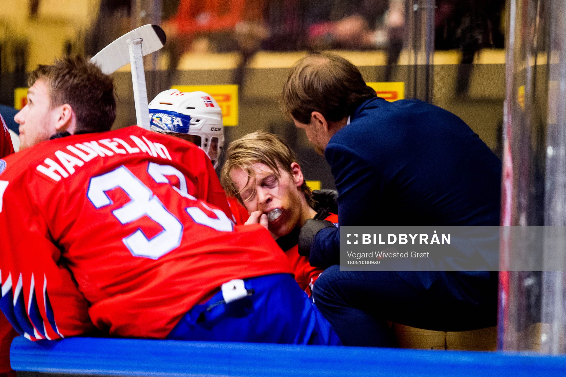 Ken Andre Olimb of Norway gets treatment from Ole Fosse,